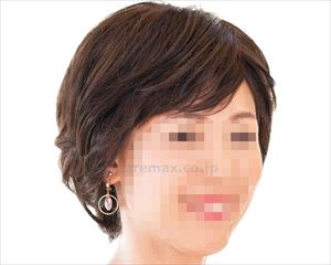 医療用ウィッグ フィットミー / MW-603 ＃2_明栗色(cm-493784)【販売単位:1】