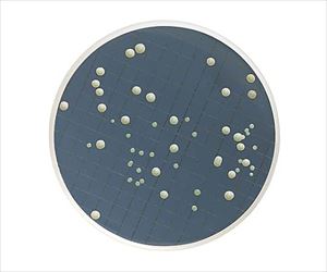 【滅菌】【冷蔵】61-0194-39 m-Green液体培地 アンプル2mL 酵母及びカビ 50×1ST MHA000P2MMe