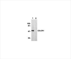 【冷蔵】【毒物】62-8445-96 Anti-C-X-X-X-C Chemokine Receptor 1, N-termin