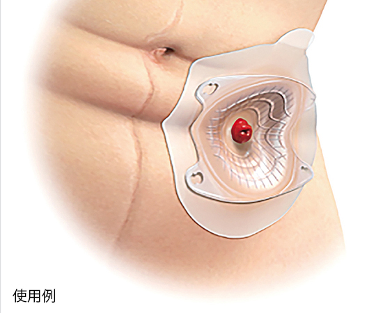 7-2952-12 センシュラ ミオ1 ライト 単品系装具・コロストミー/イレオストミー用 35φmm 不透明(ニュートラルグレ