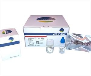 89-8279-74 ワイン内Brettanomyces bluxellensis検出 「VINOBRETT」キット（VINOB
