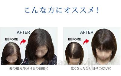 スーパーミリオンヘアー　ヘアファンデーション　スティックタイプ / 3g　ダークブラウン【販売単位:1】(cm-483787)(