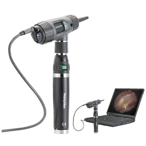 マクロビュー用送気球 23804 ﾏｸﾛﾋﾞｭｰﾖｳｿｳｷｷｭｳ(02-5531-00)【ウェルチ・アレン・ジャパン】[1個単位]