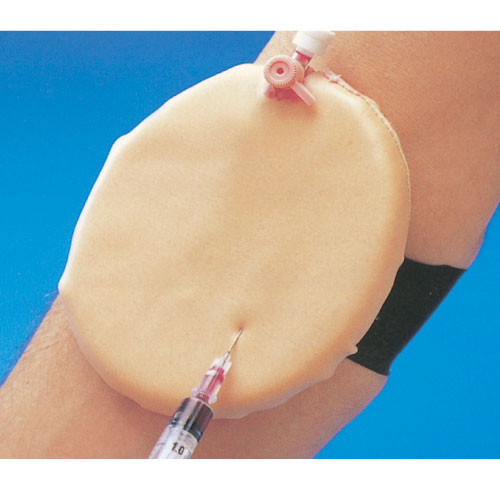 静脈穿刺パッドＡＣＦ ｼﾞｮｳﾐｬｸｾﾝｼﾊﾟｯﾄﾞ 10-0140【1組単位】(11-2705-00)