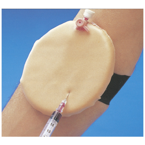 静脈穿刺パッドＡＣＦ用交換表皮 ｼﾞｮｳﾐｬｸｾﾝｼﾊﾟｯﾄﾞﾖｳﾋﾌ 10-0170【1枚単位】(11-2705-01)