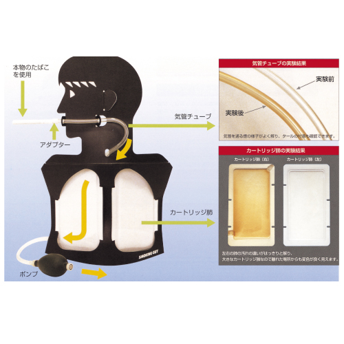 スモーキング害（ＧＵＹ） (11-2775-00)(松吉医科器械)[個]