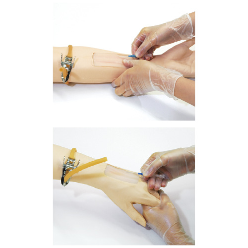 点滴静注シミュレータ Ｖライン ﾃﾝﾃｷｼﾞｮｳﾁｭｳｼﾐｭﾚｰﾀVﾗｲ 11388-000(MW9)【1組単位】(23-7751-00)