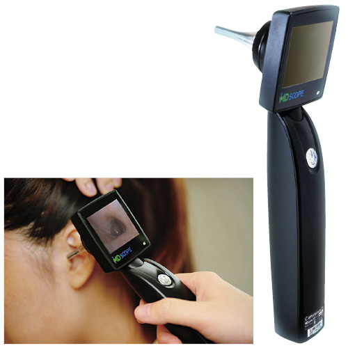 ディスポスペキュラ（小児用）シリコン AP-MS101-019(24ｺｲﾘ) ﾃﾞｨｽﾎﾟｽﾍﾟｷｭﾗ(ｼｮｳﾆﾖｳ)(24-3276-04)【エントリージャパン】[1箱単位]